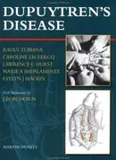 Book cover of Dupuytren's disease