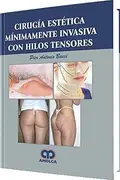 Book cover of Cirugia estetica minimamente invasiva con hilos tensores