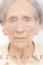 Book cover of Alzheimer