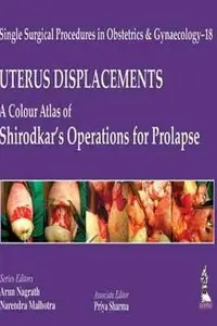 Book cover of UTERUS DISPLACEMENTS