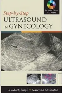 Book cover of Step by Step Ultrasound in Gynecology